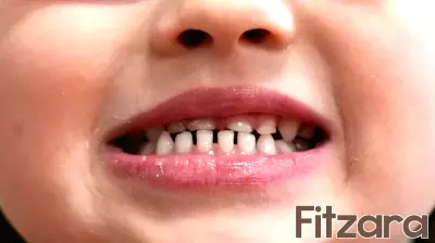 FDA Imposes Restrictions on Fluoride Supplements for Children Due to Health Concerns