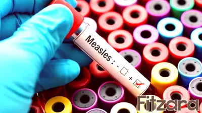 Measles Outbreak Alert in Howard County Following International Travel